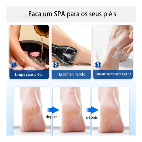 Lixadeira Pés Elétrico Recarregavel Removedor Rachaduras Calos Premium